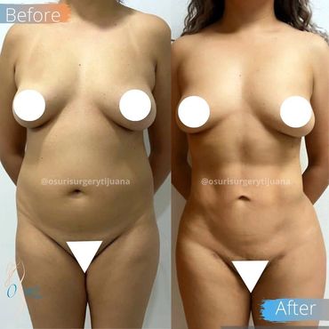 Lipo HD 4k