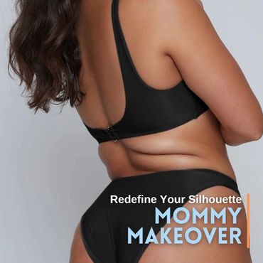 Mommy Makeover Before and After in Tijuana,  Body Contouring, Tummy Tuck, and Breast Enhancement