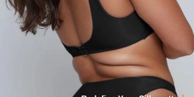 Mommy makeover in Tijuana combining tummy tuck, breast surgery, and body contouring procedures.