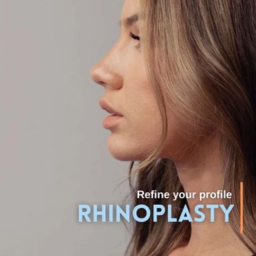 Rhinoplasty in Tijuana