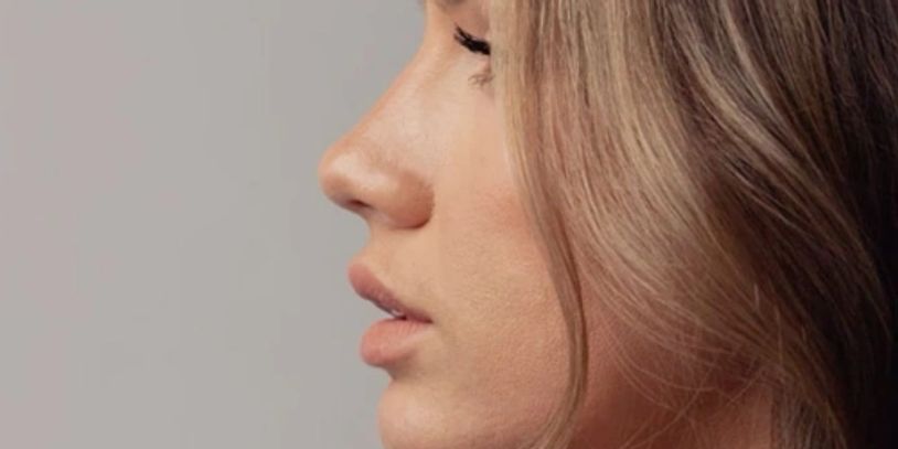 Rhinoplasty & Nose Reshaping in Tijuana