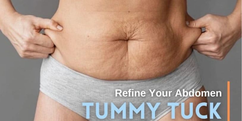 Tummy Tuck Surgery in Tijuana, Mexico