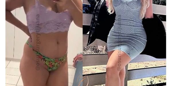 Comparación de fotos de una mujer en diferentes atuendos.