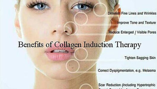 anti-aging, Collagen Induction Therapy