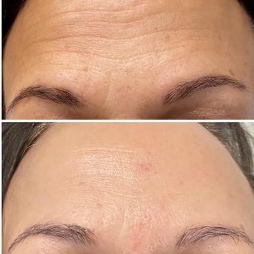 Before & After Results
