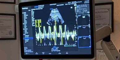 2D Heartbeat Check at Sunbeam Sonogram