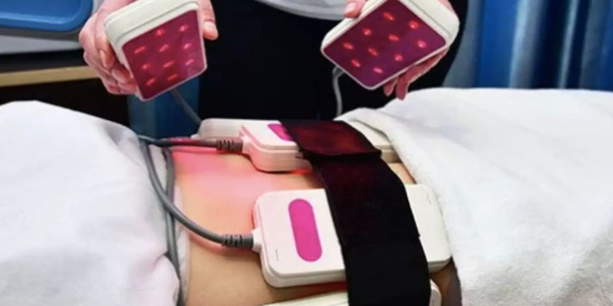 Laser Lipolysis