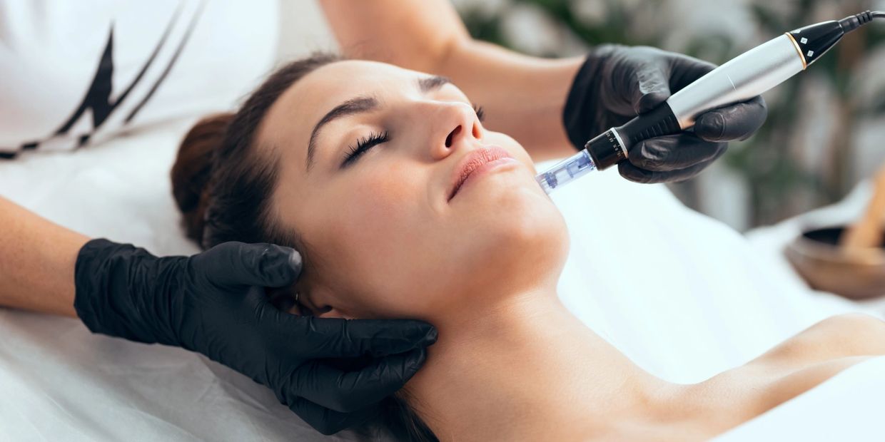 microneedling on the face
