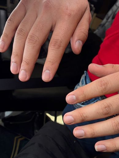 Two hands with natural, clean fingernails in a casual setting.