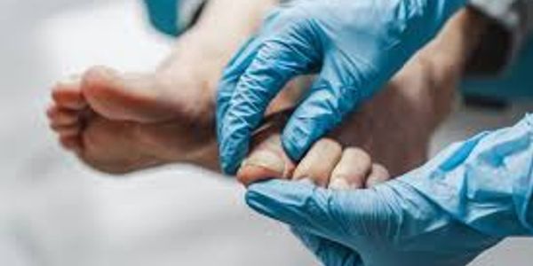 Gloved hands examining a person's toes, likely a medical check-up.