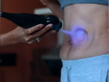 CRYO SLIMMING

The Subzero freezes and eliminates fat cells, offering a painless method for body con