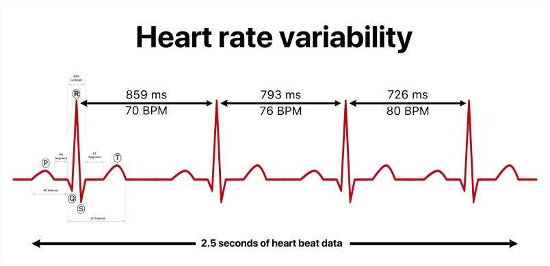 By YitzhakNat - Own work + ECG wave from, CC BY-SA 4.0, https://commons.wikimedia.org/w/index.php?curid=121207798