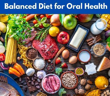The Impact of Diet on Oral Health