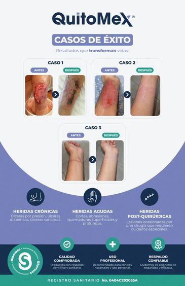 Casos de éxito de QuitoMex mostrando la mejora de heridas.