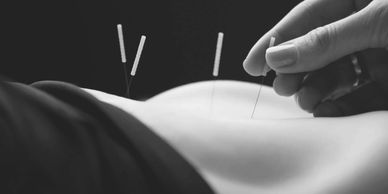 Acupuntrure involevs the insertion of  very thin needels through your skin at strategic points on yo