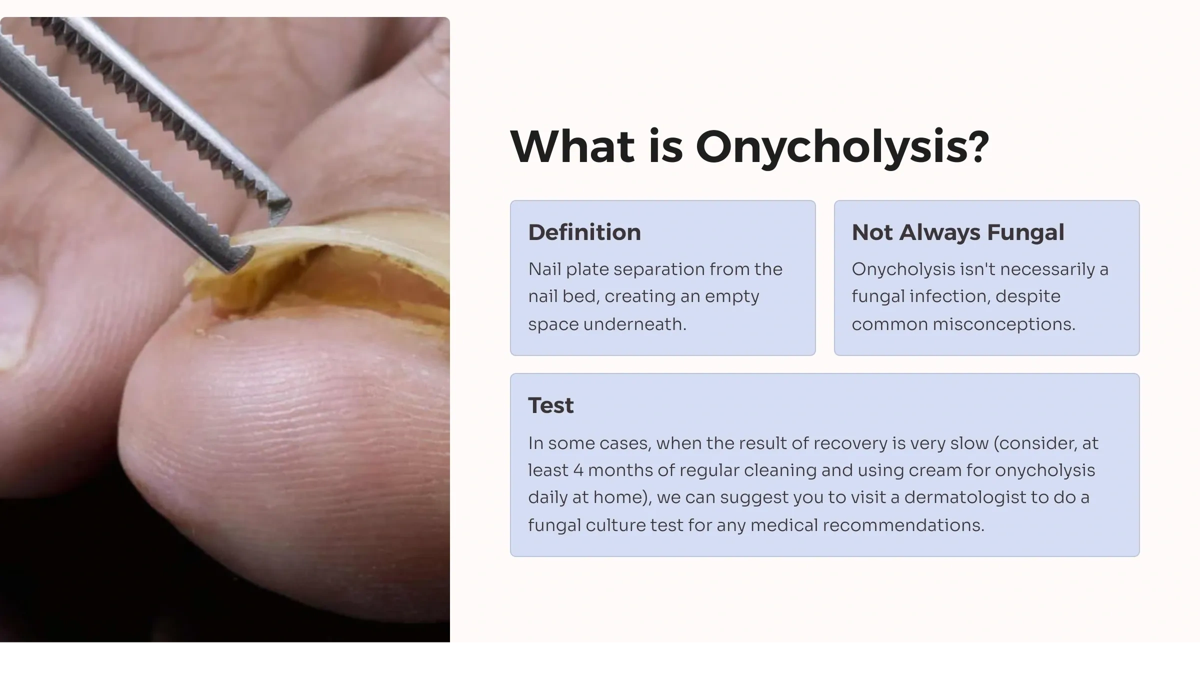 ingrown toenails, ingrown, podiatry, podiatry doha, foot care center qatar, foot care