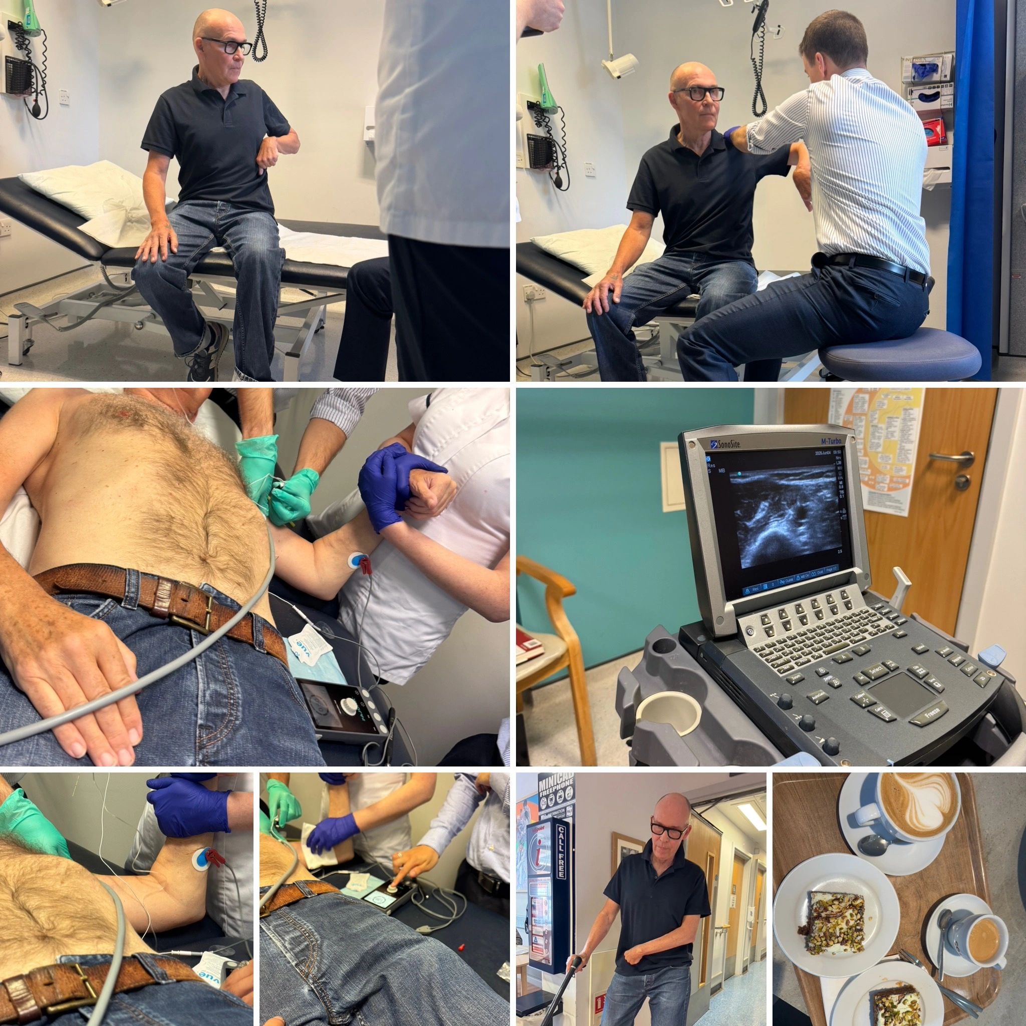 Stroke Nerve Block Study