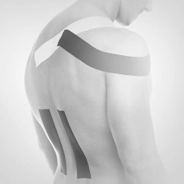 Patient displaying where they have been taped.