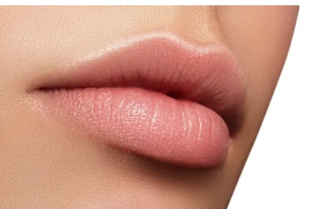 Lip Filler