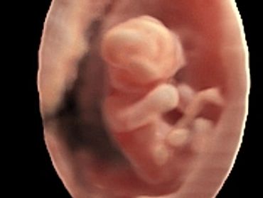 11-weeks-3d-baby-ultrasound-picture
