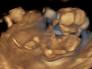3D Ultrasound picture of baby all stretched out, at exactly 26 weeks pregnant.