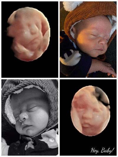4D ultrasound baby before and after pictures