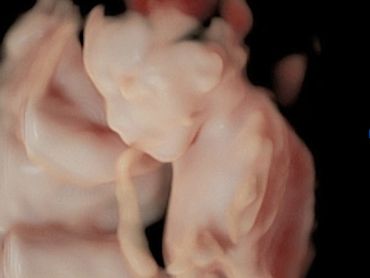 3D ultrasound image at 21 weeks 2 days of baby next to the placenta, umbilical cord in background.