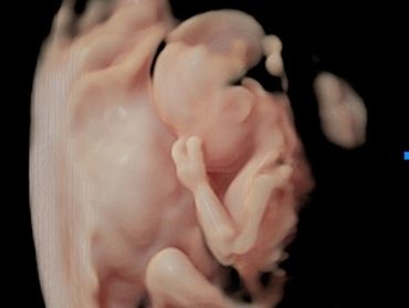 3D ultrasound image at 21 weeks 2 days of baby next to the placenta, thumb near cheek.
