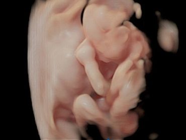 3D ultrasound image at 21 weeks 2 days of baby next to the placenta.