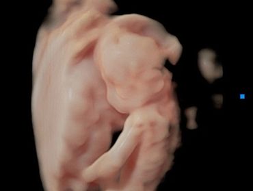 3D ultrasound image at 21 weeks 2 days of baby next to the placenta.