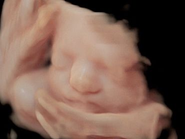 3D Ultrasound Face Picture in Virtual HD at 28 weeks pregnant.