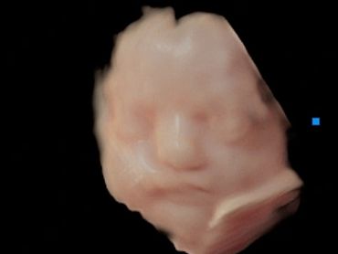 3D Ultrasound Face Picture in Virtual HD at 28 weeks pregnant.