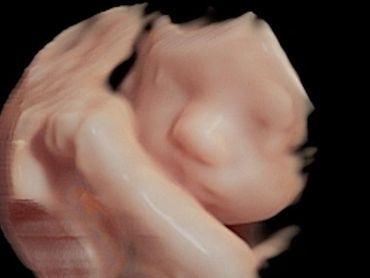 3D Ultrasound Face Picture in virtual HD at 28 weeks pregnant.