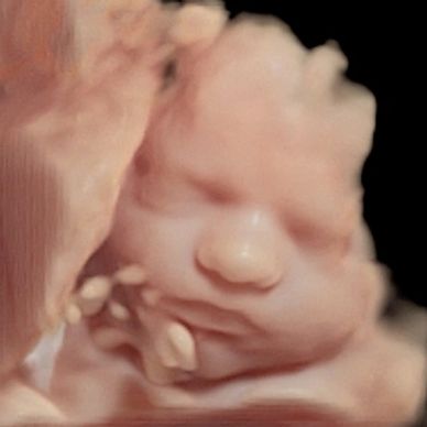 4D ultrasound picture of baby's full face