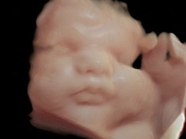 3D ultrasound picture at 32 weeks pregnant.