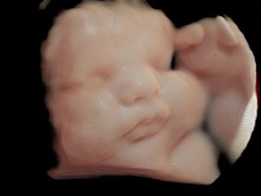 3D ultrasound picture at 32 weeks pregnant.