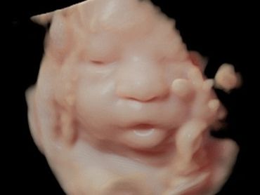 3D Ultrasound Face Picture in Virtual HD at 33 Weeks Pregnant of baby's mouth open.