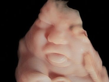 3D Ultrasound Face Picture in Virtual HD at 33 Weeks Pregnant of baby's tongue sticking out.