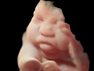 3D Ultrasound Face Picture in Virtual HD at 33 Weeks Pregnant of baby's tongue sticking out.