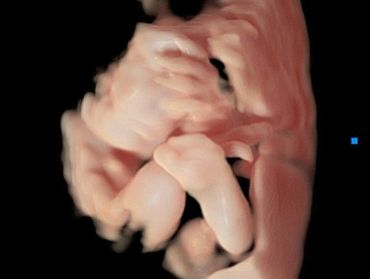 3D Ultrasound Picture in Virtual HD of Baby's Foot and Hand near the face.