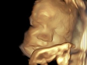 3D Ultrasound Picture of Baby's Hand near the face.
