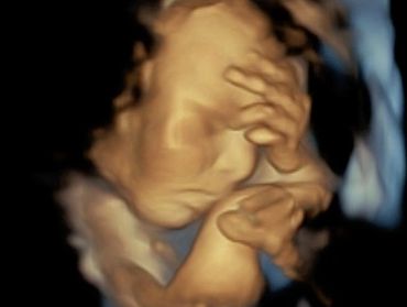 3D Ultrasound Picture of Baby's Hand near the face.