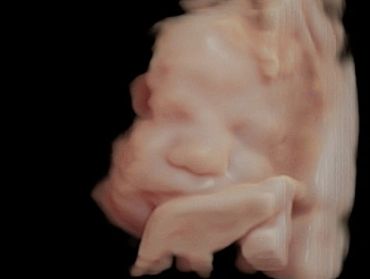 3D Ultrasound Picture in Virtual HD of Baby's Hand near the face.