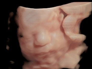 34 weeks 3D ultrasound picture of baby's face.
