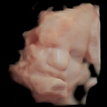 3D Ultrasound Picture at 34 Weeks Pregnant showing baby's face in virtual hd