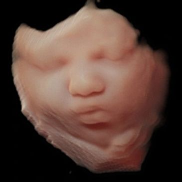 3D Ultrasound Picture in Virtual HD in the 3rd Trimester