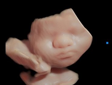 3D ultrasound of baby at 38 weeks pregnant