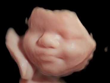 3D ultrasound of baby at 38 weeks pregnant