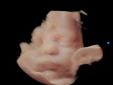 3D Baby Ultrasound Picture of baby's face