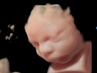 3D Baby Ultrasound Picture of baby's face